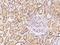 GLI Pathogenesis Related 1 antibody, 201285-T08, Sino Biological, Immunohistochemistry paraffin image 