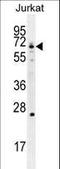 Glutamate-Cysteine Ligase Catalytic Subunit antibody, LS-C166412, Lifespan Biosciences, Western Blot image 