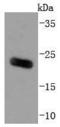 ADP Ribosylation Factor 6 antibody, A00927-1, Boster Biological Technology, Western Blot image 