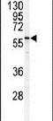 Serine Palmitoyltransferase Long Chain Base Subunit 1 antibody, PA5-12221, Invitrogen Antibodies, Western Blot image 