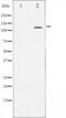 Nuclear Factor Of Activated T Cells 3 antibody, GTX52371, GeneTex, Western Blot image 