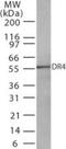 TNF Receptor Superfamily Member 10a antibody, NBP2-27415, Novus Biologicals, Western Blot image 
