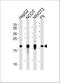 High Mobility Group AT-Hook 2 antibody, A00436-2, Boster Biological Technology, Western Blot image 