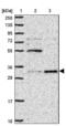 UMP-CMP kinase antibody, NBP2-47587, Novus Biologicals, Western Blot image 