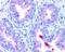 ATP Binding Cassette Subfamily A Member 1 antibody, NB400-105B, Novus Biologicals, Immunohistochemistry paraffin image 