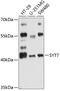 Synaptotagmin 7 antibody, 14-616, ProSci, Western Blot image 