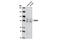 BR Serine/Threonine Kinase 2 antibody, 5460S, Cell Signaling Technology, Western Blot image 