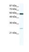 ZFP91 Zinc Finger Protein antibody, NBP1-80136, Novus Biologicals, Western Blot image 