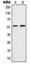 Heterogeneous Nuclear Ribonucleoprotein F antibody, LS-C352305, Lifespan Biosciences, Western Blot image 