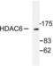 Histone Deacetylase 6 antibody, LS-C176060, Lifespan Biosciences, Western Blot image 