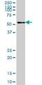 Tubulin Folding Cofactor E antibody, H00006905-B01P, Novus Biologicals, Western Blot image 