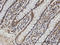 Family With Sequence Similarity 3 Member B antibody, LS-C134080, Lifespan Biosciences, Immunohistochemistry paraffin image 