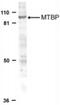 MDM2 Binding Protein antibody, NBP1-76747, Novus Biologicals, Western Blot image 