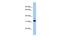 ANTXR Cell Adhesion Molecule 2 antibody, PA5-43529, Invitrogen Antibodies, Western Blot image 