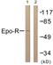 Erythropoietin Receptor antibody, PA5-38484, Invitrogen Antibodies, Western Blot image 