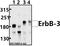 Erb-B2 Receptor Tyrosine Kinase 3 antibody, A00539-3, Boster Biological Technology, Western Blot image 