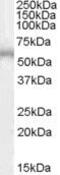 Adrenoceptor Beta 1 antibody, PA5-18482, Invitrogen Antibodies, Western Blot image 