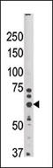 Synoviolin 1 antibody, 61-137, ProSci, Western Blot image 