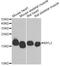 Myosin Light Chain 2 antibody, A14188, ABclonal Technology, Western Blot image 