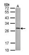 Major Histocompatibility Complex, Class II, DR Beta 3 antibody, NBP1-33666, Novus Biologicals, Western Blot image 