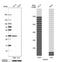 Voltage Dependent Anion Channel 2 antibody, NBP1-89477, Novus Biologicals, Western Blot image 