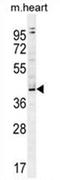 EG382639 antibody, AP54614PU-N, Origene, Western Blot image 