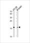 Transmembrane Protein 160 antibody, PA5-49405, Invitrogen Antibodies, Western Blot image 