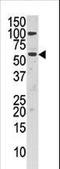 Choline Kinase Alpha antibody, LS-C100962, Lifespan Biosciences, Western Blot image 