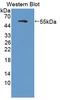 Matrix Metallopeptidase 1 antibody, LS-C690165, Lifespan Biosciences, Western Blot image 