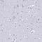 TNF Superfamily Member 11 antibody, HPA045142, Atlas Antibodies, Immunohistochemistry frozen image 