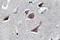 Interleukin 12A antibody, GTX66715, GeneTex, Immunohistochemistry paraffin image 