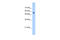 Podocalyxin Like antibody, 31-353, ProSci, Western Blot image 