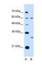 Tetraspanin 32 antibody, NBP1-62646, Novus Biologicals, Western Blot image 