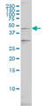 Proteasome 26S Subunit, ATPase 2 antibody, LS-C198018, Lifespan Biosciences, Western Blot image 