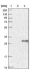 Transmembrane Protein 179B antibody, NBP1-86062, Novus Biologicals, Western Blot image 