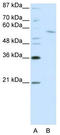 REST Corepressor 1 antibody, TA343772, Origene, Western Blot image 