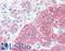 SRC Proto-Oncogene, Non-Receptor Tyrosine Kinase antibody, LS-B3266, Lifespan Biosciences, Immunohistochemistry frozen image 