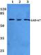 Glutamate Decarboxylase 1 antibody, PA5-36054, Invitrogen Antibodies, Western Blot image 