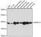 Beta-1,4-Galactosyltransferase 4 antibody, GTX66282, GeneTex, Western Blot image 