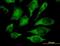 Mitogen-Activated Protein Kinase 13 antibody, orb94748, Biorbyt, Immunocytochemistry image 