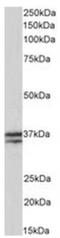 Troponin T2, Cardiac Type antibody, NBP2-26095, Novus Biologicals, Western Blot image 