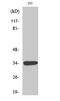 Growth Differentiation Factor 15 antibody, STJ93253, St John