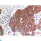 Beclin 1 antibody, LS-C813667, Lifespan Biosciences, Immunohistochemistry paraffin image 