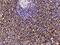 CD16 antibody, GTX02054, GeneTex, Immunohistochemistry paraffin image 