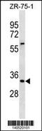 Inhibitor Of Growth Family Member 2 antibody, 60-529, ProSci, Western Blot image 