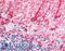 Solute Carrier Family 1 Member 3 antibody, LS-A9445, Lifespan Biosciences, Immunohistochemistry frozen image 
