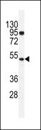 DNA Nucleotidylexotransferase antibody, LS-C161788, Lifespan Biosciences, Western Blot image 