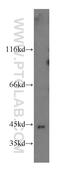 GTP-binding protein 5 antibody, 20133-1-AP, Proteintech Group, Western Blot image 