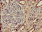 Phosphoribosyl Pyrophosphate Synthetase 2 antibody, LS-C679197, Lifespan Biosciences, Immunohistochemistry paraffin image 