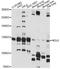 Nucleolar Protein 6 antibody, A14420, ABclonal Technology, Western Blot image 